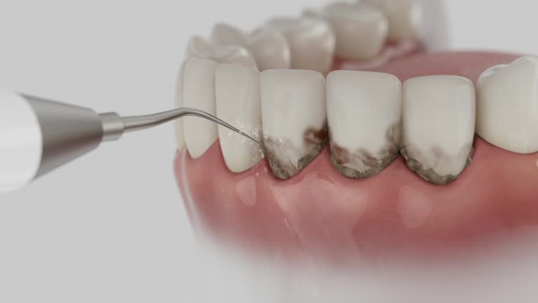 Reliable Dental contractor in Beaver Dam, WI by Smile Center Dentistry